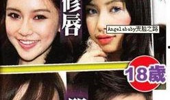 西安整容爆料事件视频最新,揭秘行业乱象，患者权益引关注